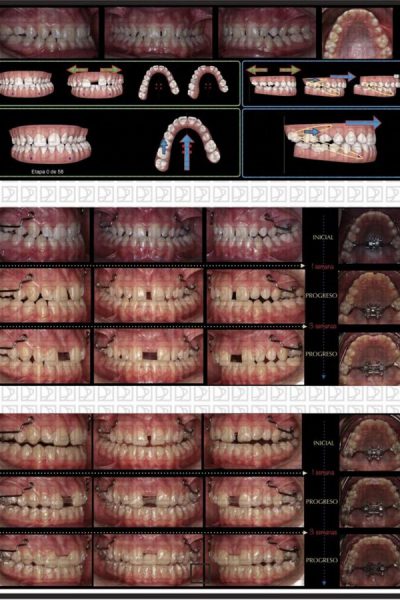 casos-clinicos-curso-Minimplantes-20192041