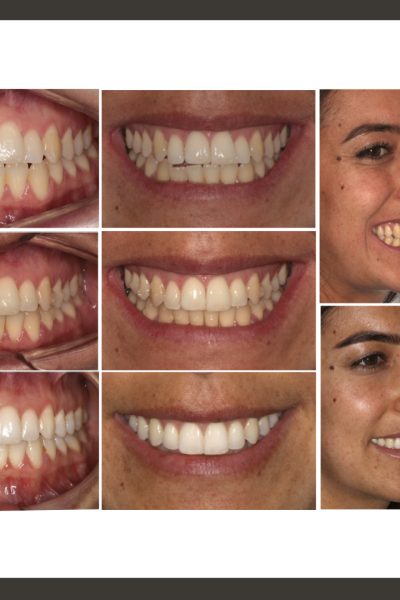 ‎casos ramon.‎001