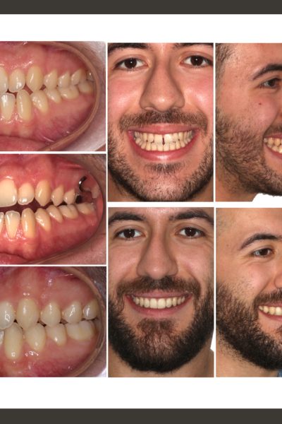 ‎casos ramon.‎002