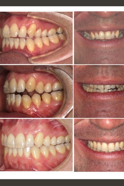 ‎casos ramon.‎004