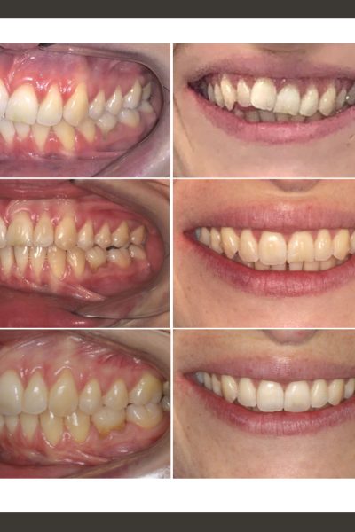 ‎casos ramon.‎005