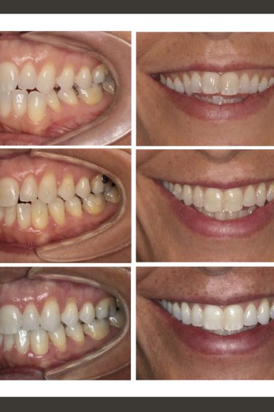 ‎casos ramon.‎006