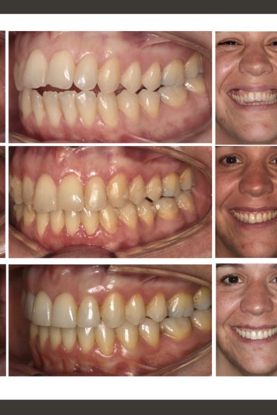 ‎casos ramon.‎007