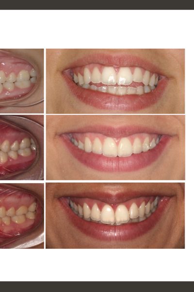 ‎casos ramon.‎008