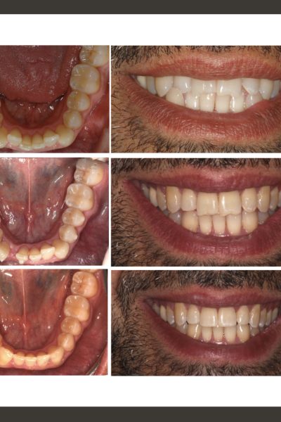 ‎casos ramon.‎009