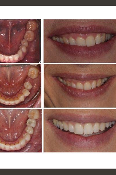 ‎casos ramon.‎010