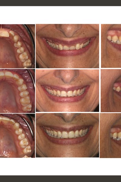 ‎casos ramon.‎011