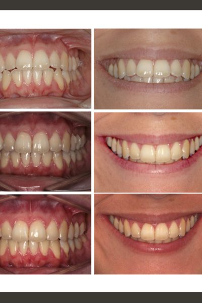 ‎casos ramon.‎012