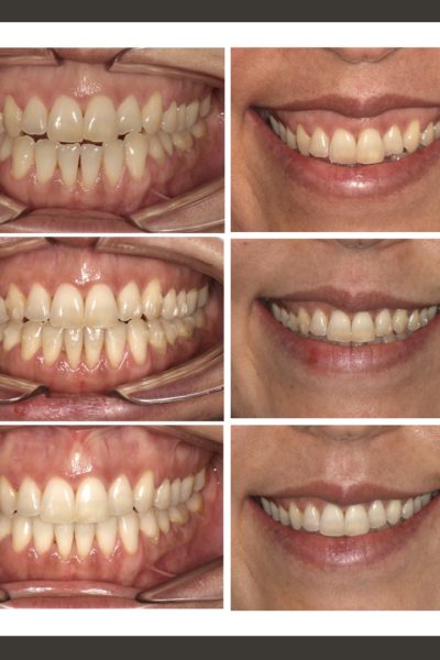 ‎casos ramon.‎013