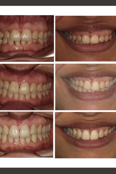 ‎casos ramon.‎014