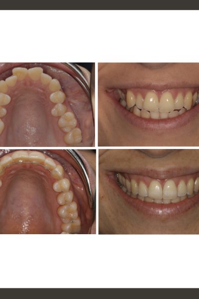 ‎casos ramon.‎015