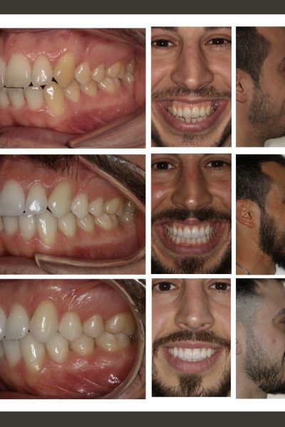 ‎casos ramon.‎016