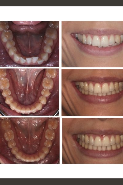 ‎casos ramon.‎017